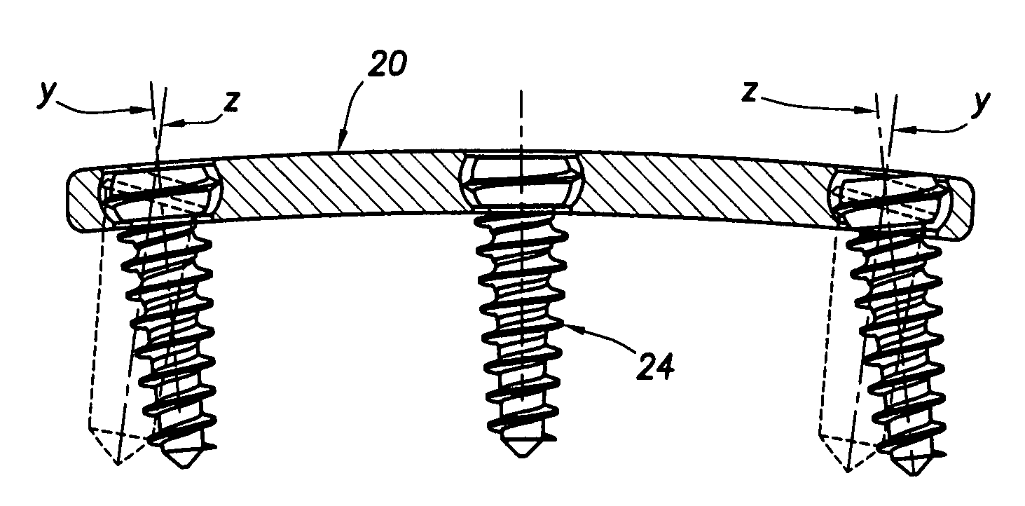 Multi-axis connection and methods for internal spinal stabilizers