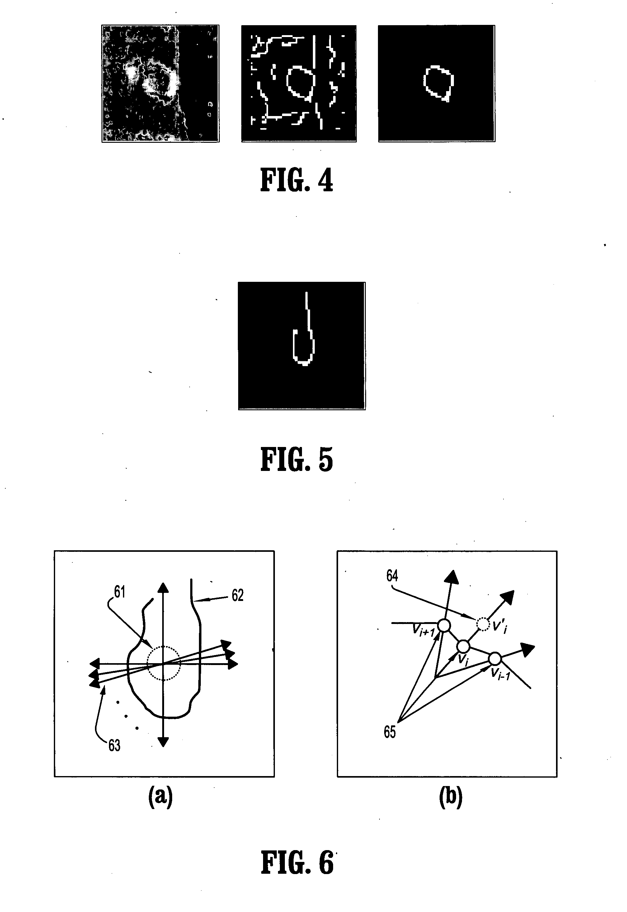 System and Method For Tracing Rib Posterior In Chest CT Volumes