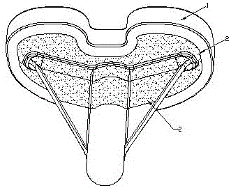 Improved artificial knee joint tibial tray with porous film and preparation method thereof