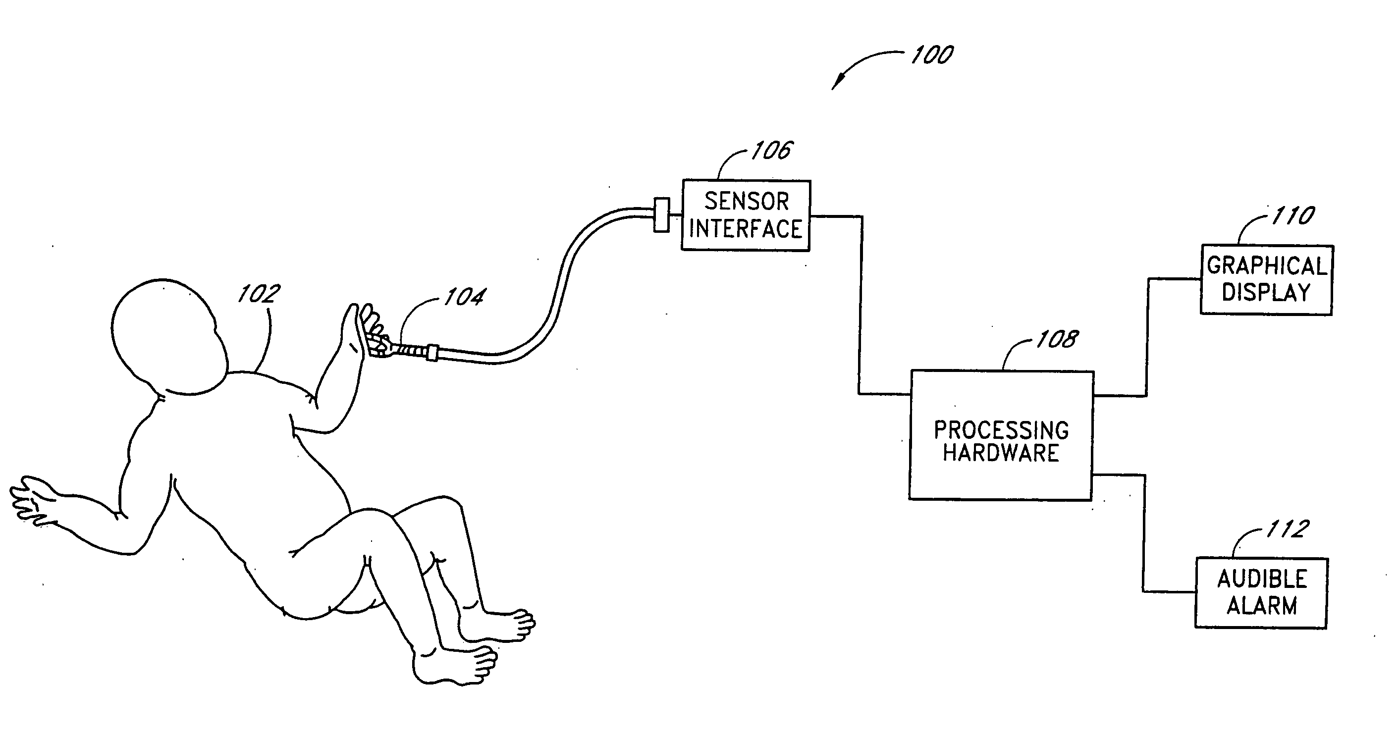 Method and apparatus for measuring pulsus paradoxus