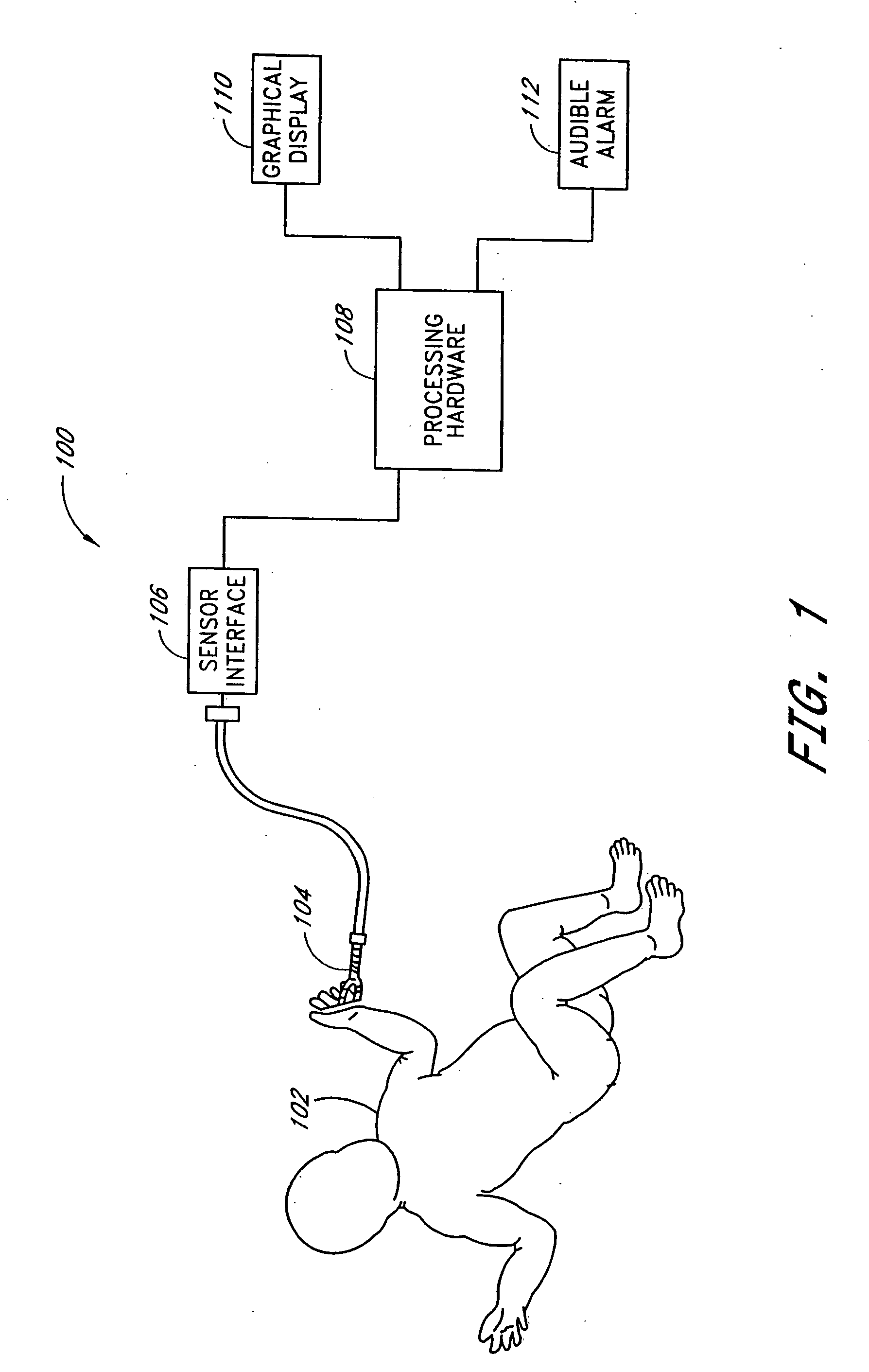 Method and apparatus for measuring pulsus paradoxus