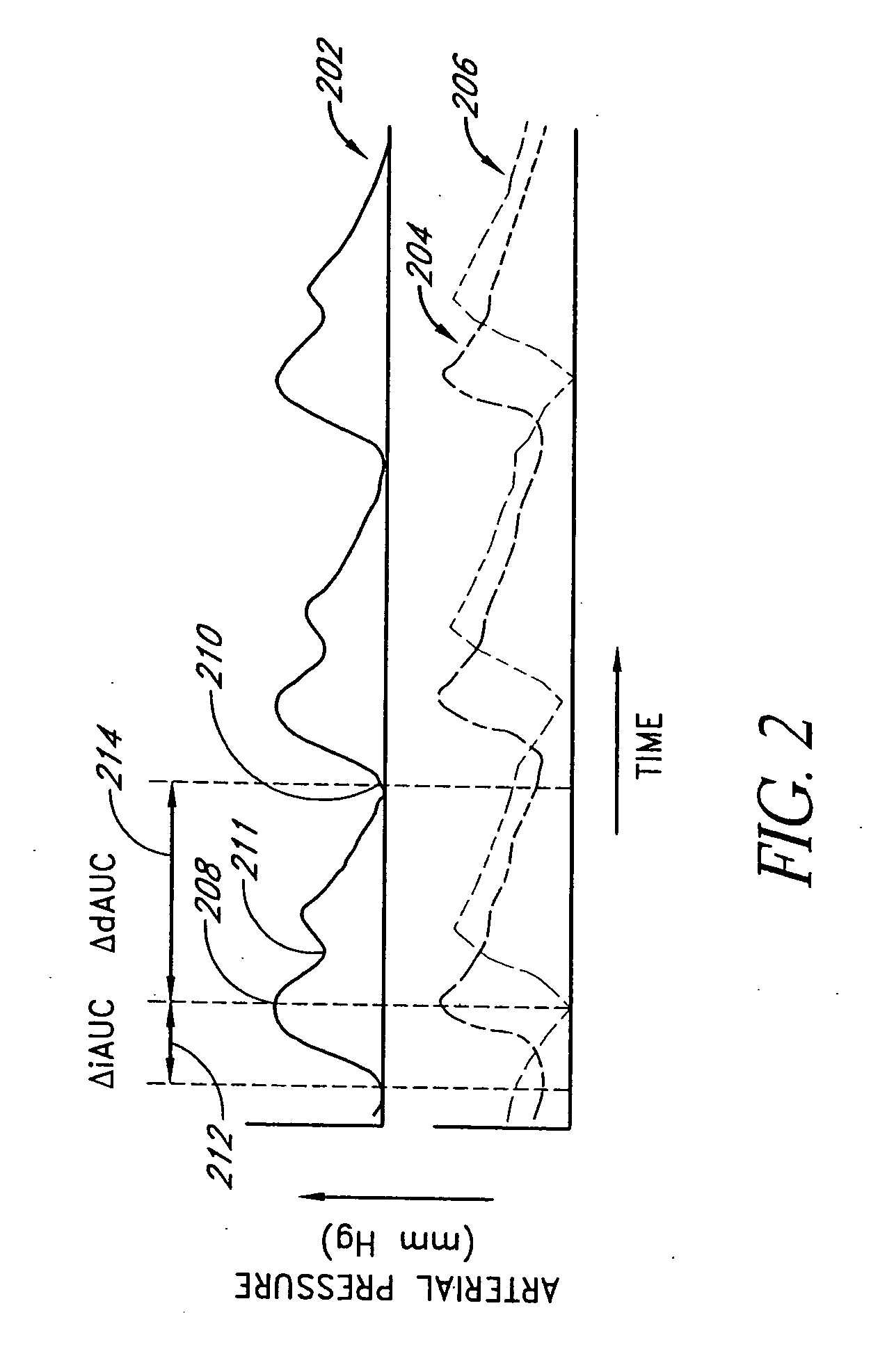 Method and apparatus for measuring pulsus paradoxus