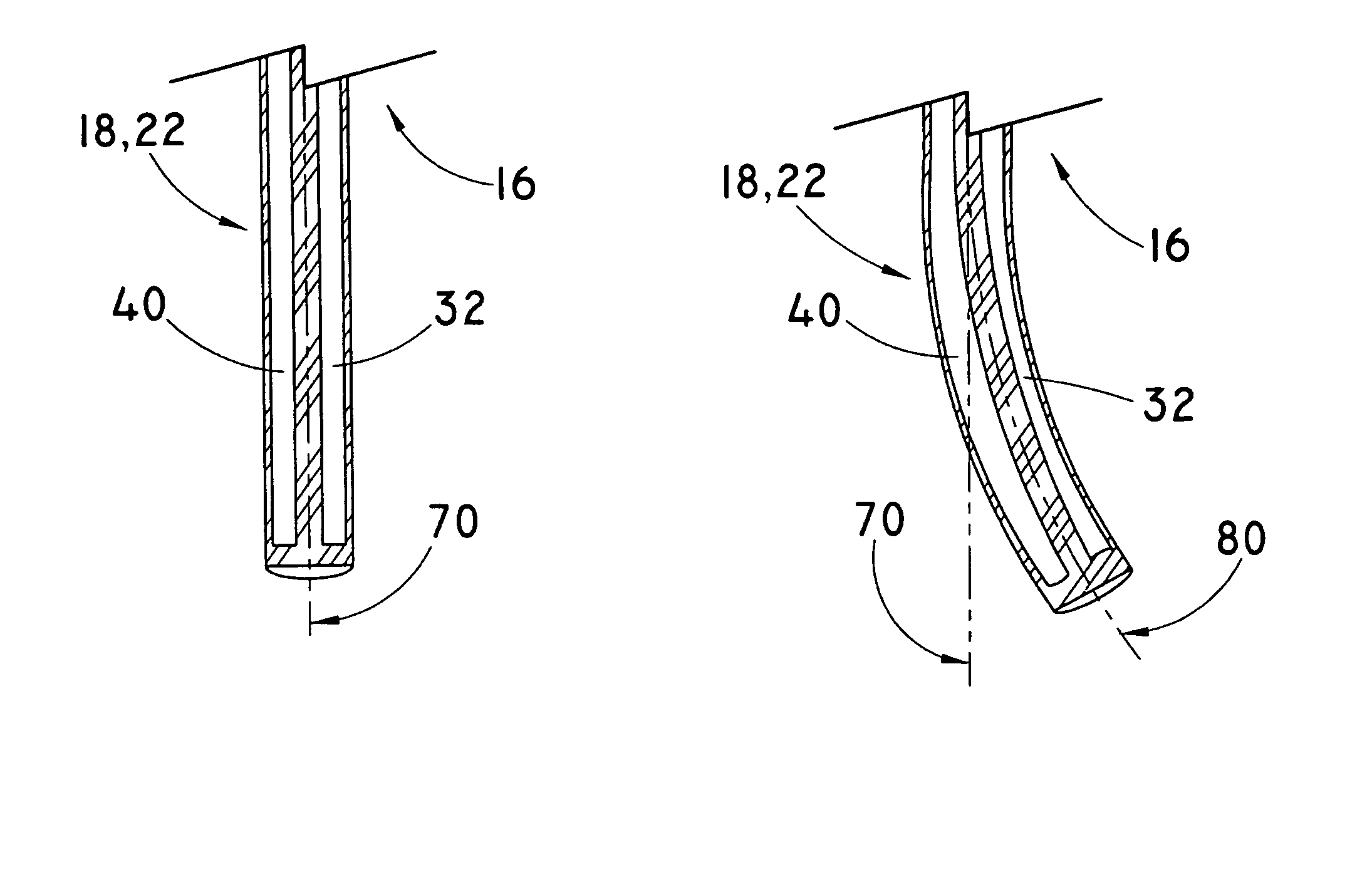 Steerable catheter devices and methods of articulating catheter devices