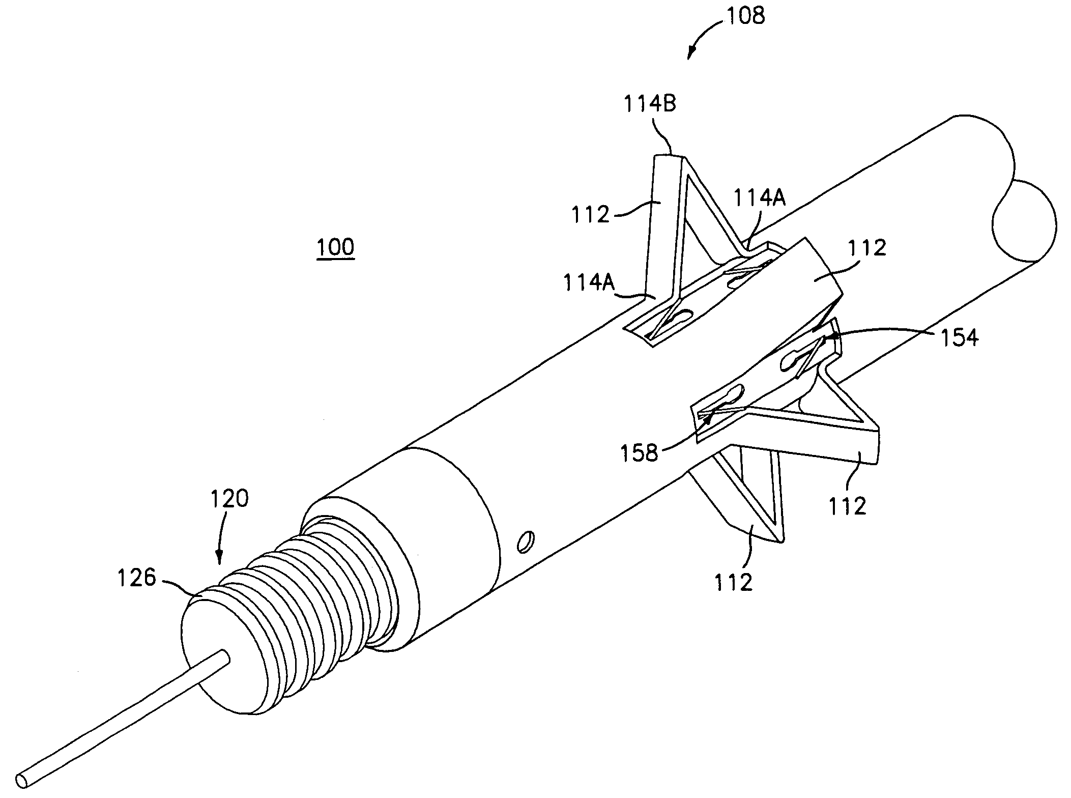 Method and apparatus for anastomosis including an anchoring sleeve