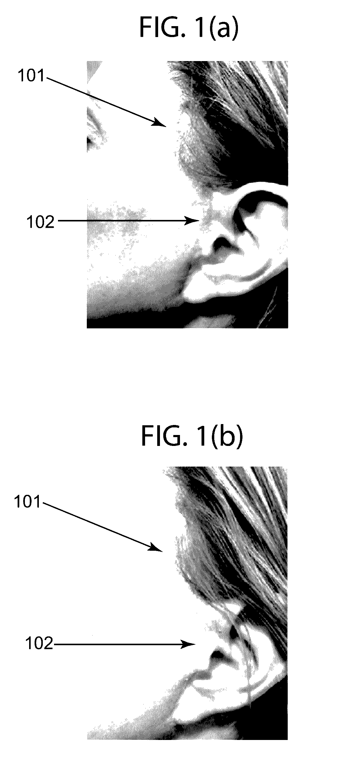 Method for applying a skin treatment