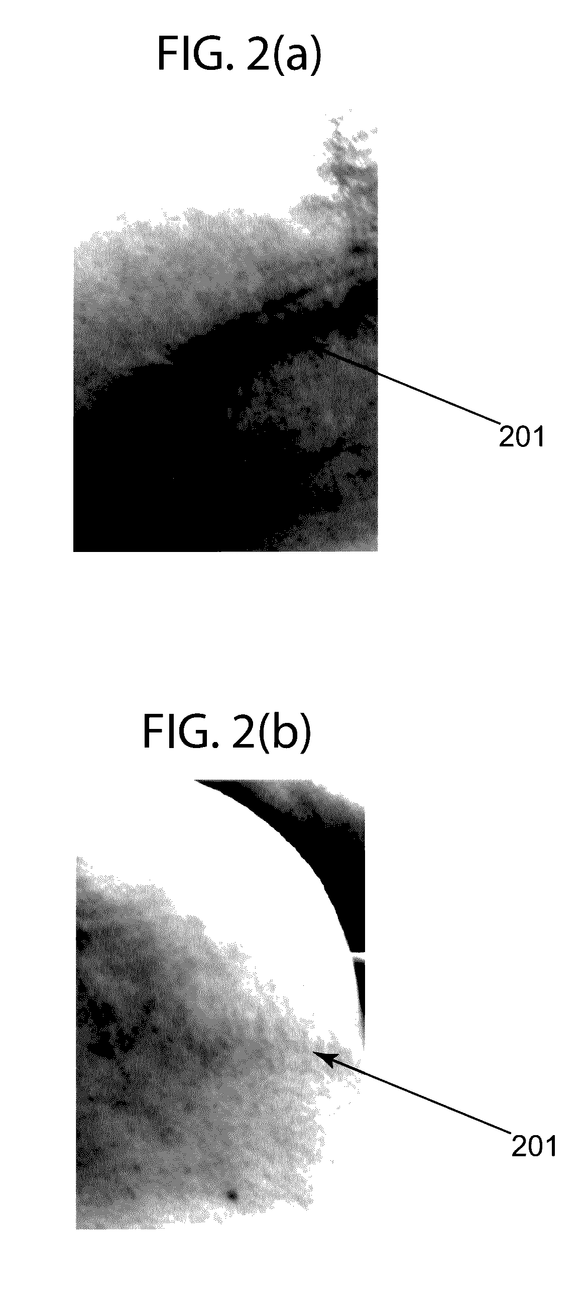 Method for applying a skin treatment