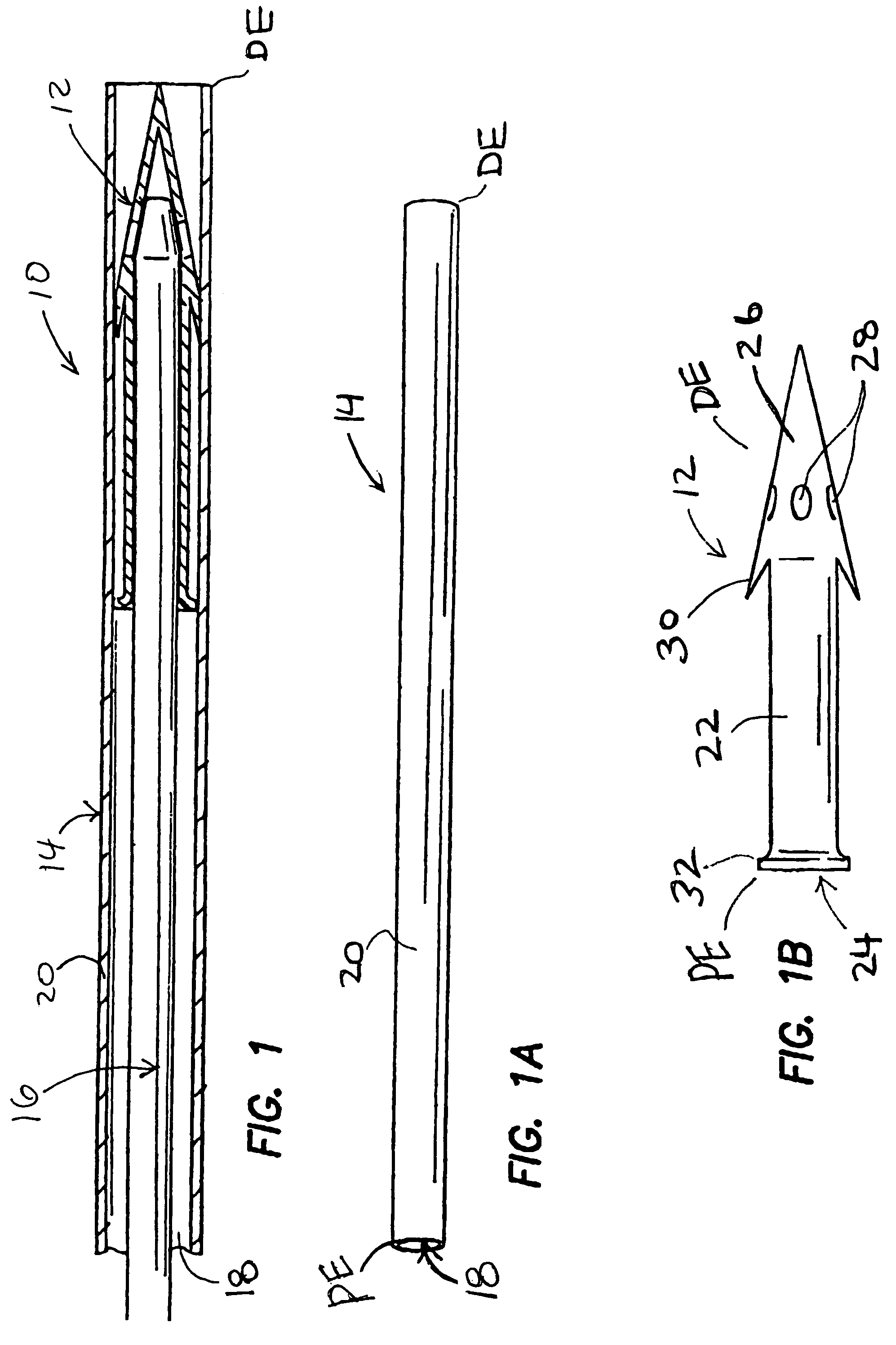 Methods and devices for draining fluids and lowering intraocular pressure