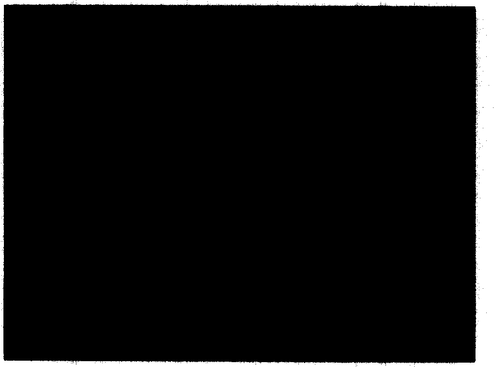 Low antigen hetero stroma of cornea treated by frozen, and its preparation method