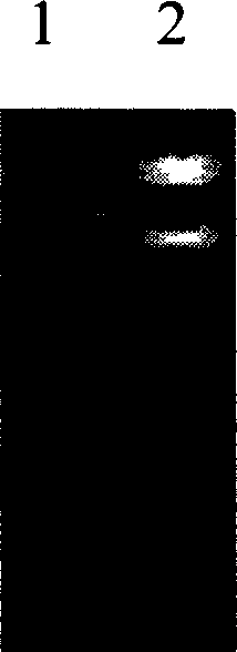 Saccharomyce engineering strain for expressing cbh2 gene and its construction method