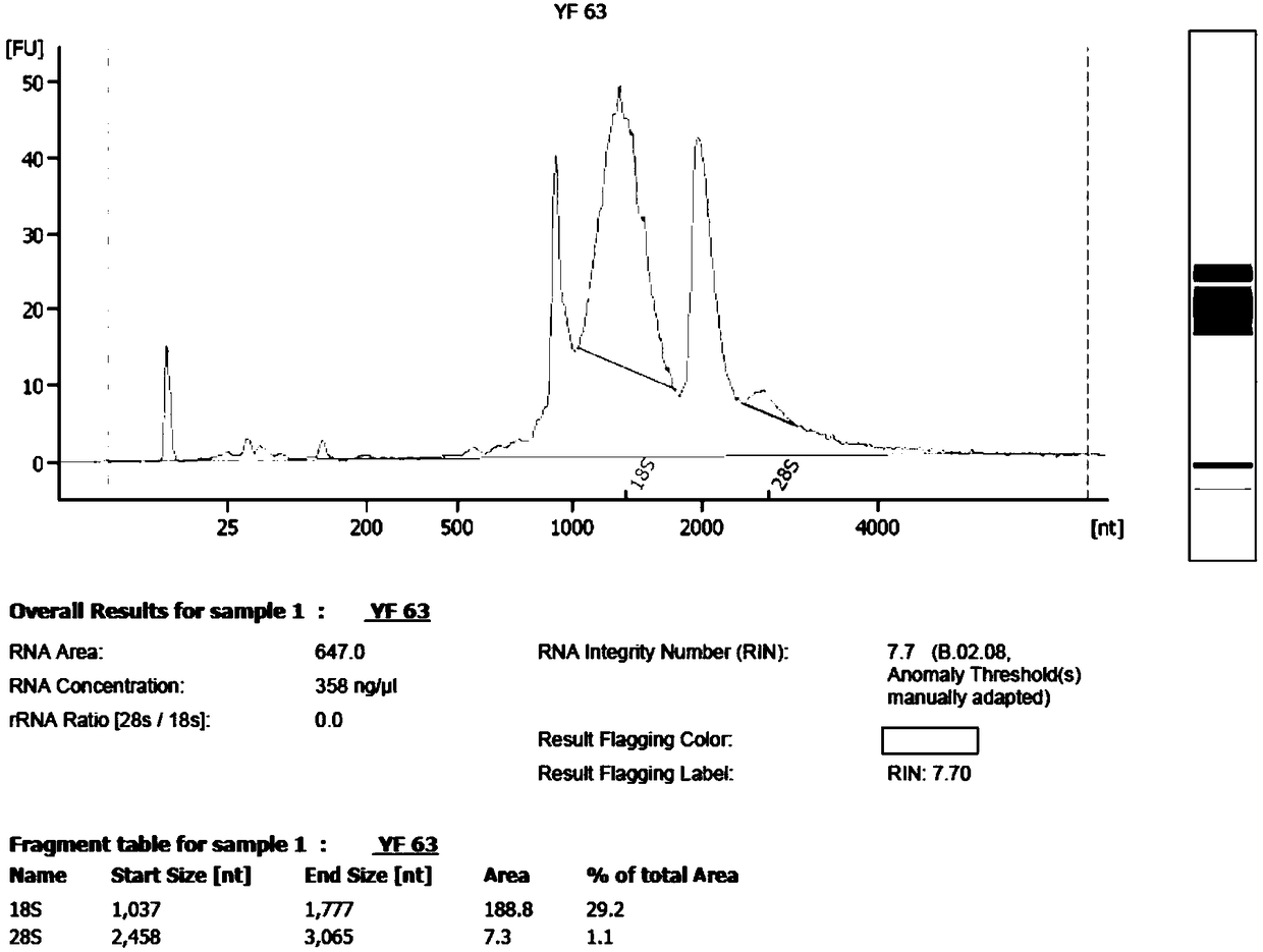 Primer pairs, probe, kit and one-step detecting method for detecting tumor fusion gene EWS-FLI1