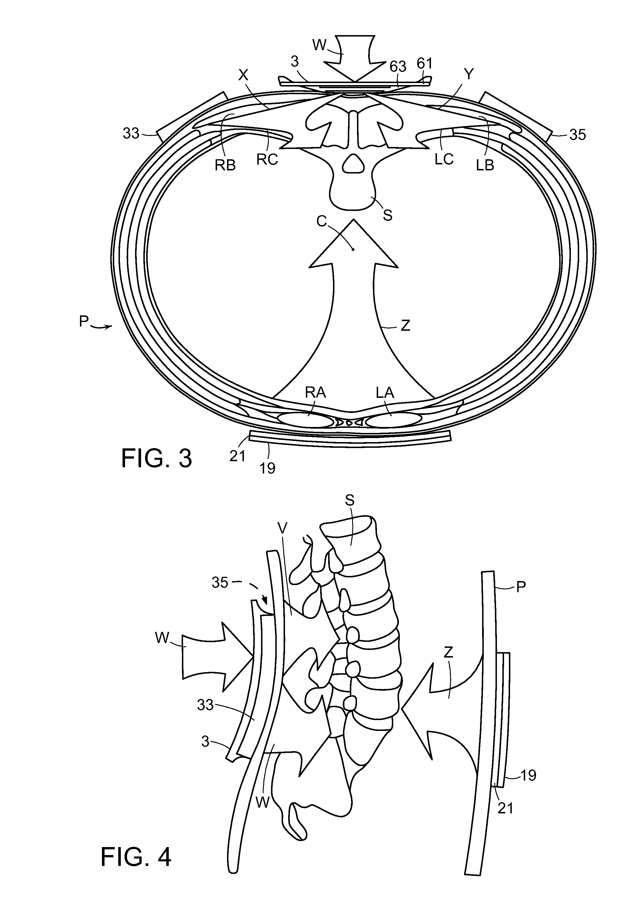 Back orthosis and orthotic method