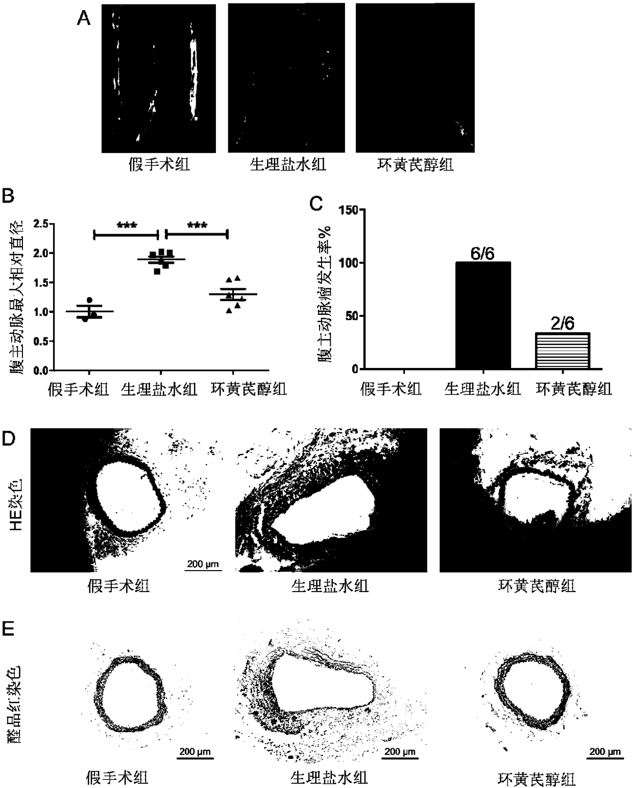 Application of cycloastragenol to preparation of drug for inhibiting abdominal aortic aneurysm