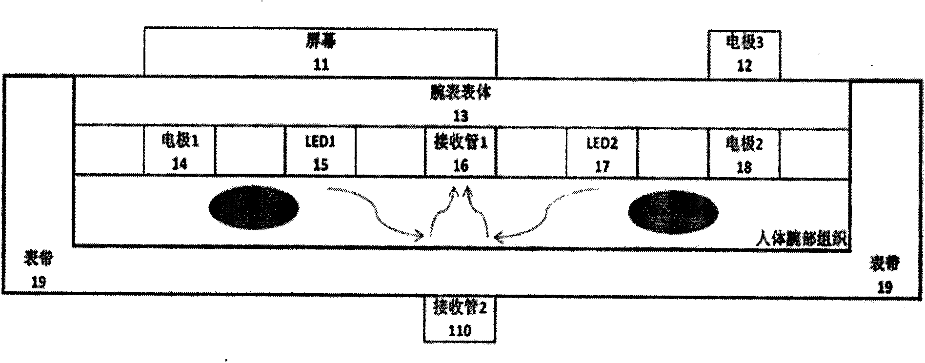 Intelligent electrocardiograph monitoring device based on potential and photoelectric detection method