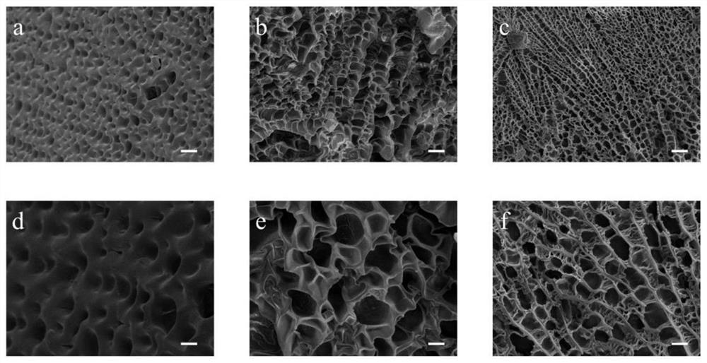 A copolymer-based sugar-sensitive microneedle patch containing 3-acrylamidophenylboronic acid