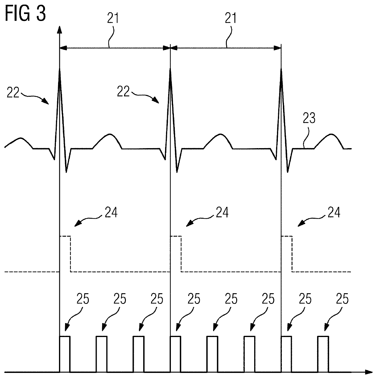 Method for acquiring x-ray data, x-ray device, computer program and electronically readable storage medium