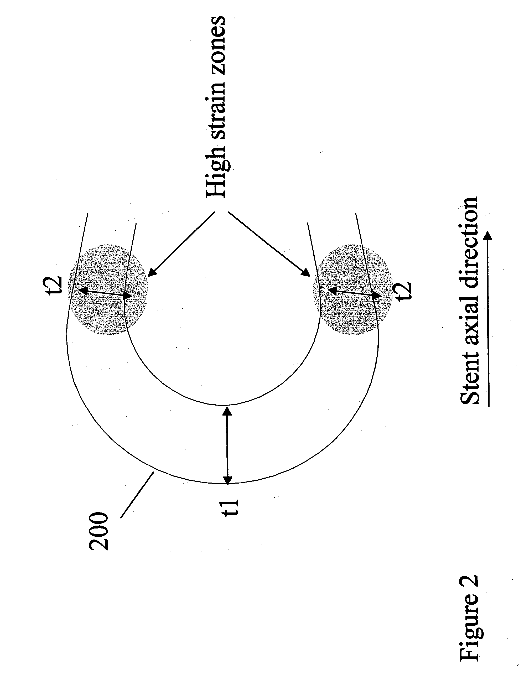 Polymeric stent having modified molecular structures in both the hoops and selected segments of the flexible connectors