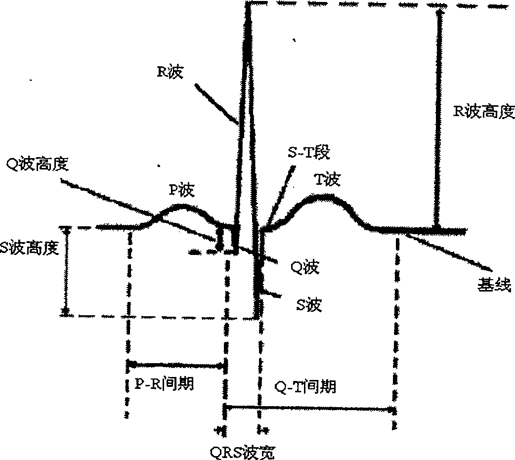 Cardioelectric characteristic extracting process based on evolutive wavelet wiener deconvolution