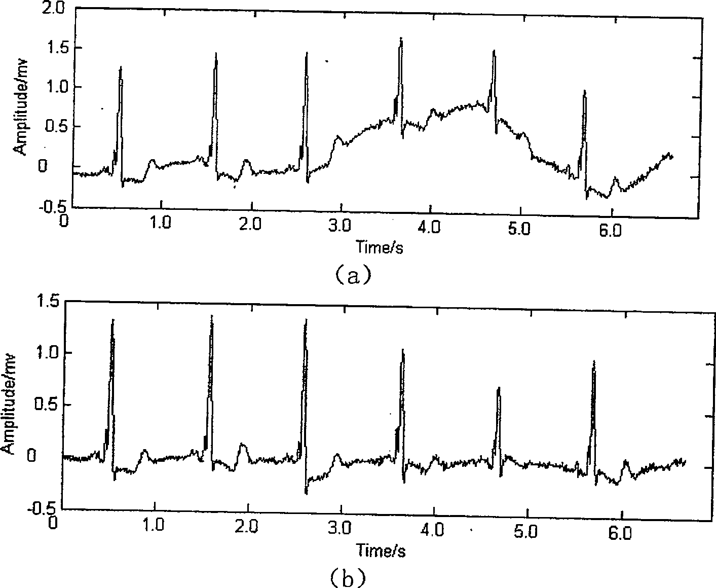 Cardioelectric characteristic extracting process based on evolutive wavelet wiener deconvolution