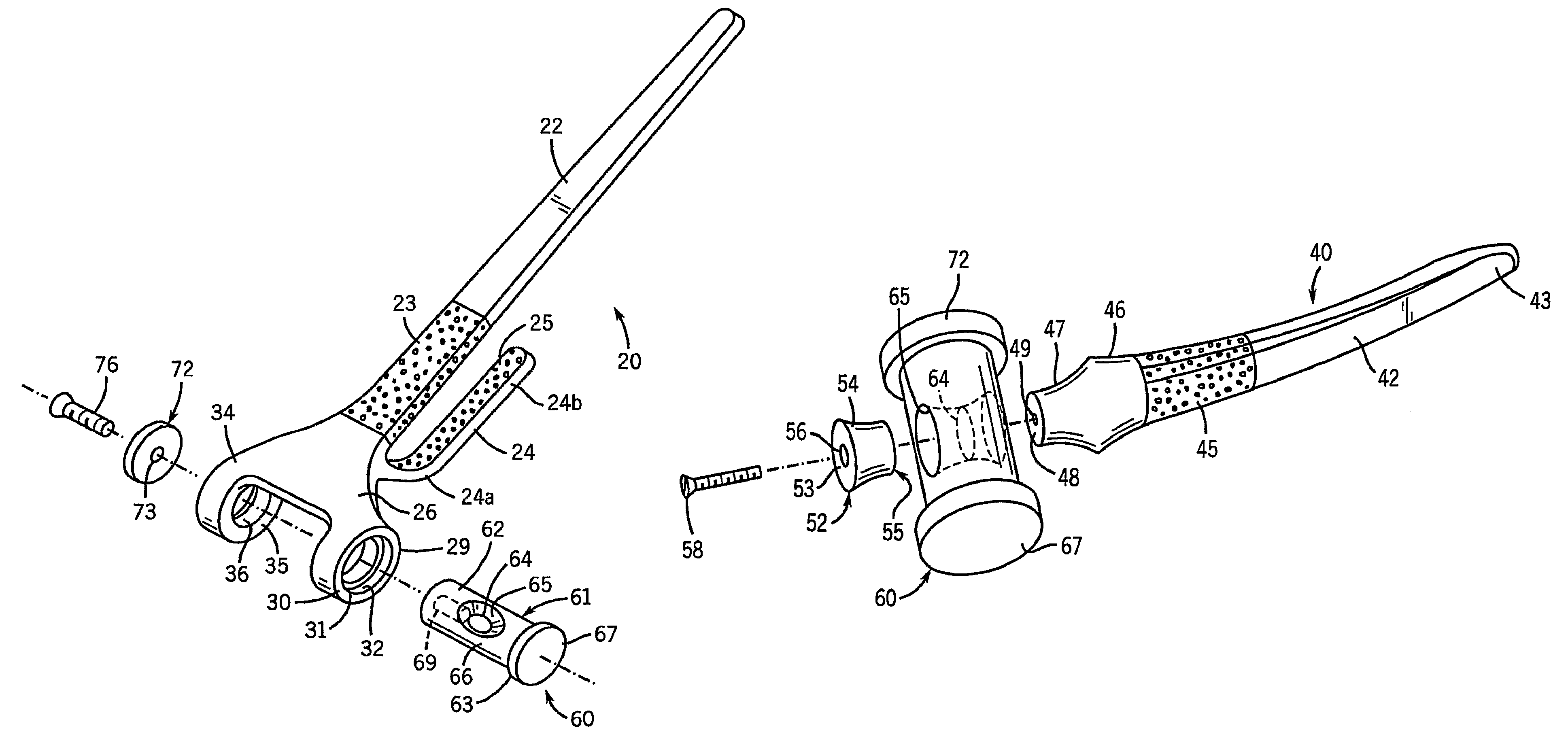 Prosthetic elbow replacement