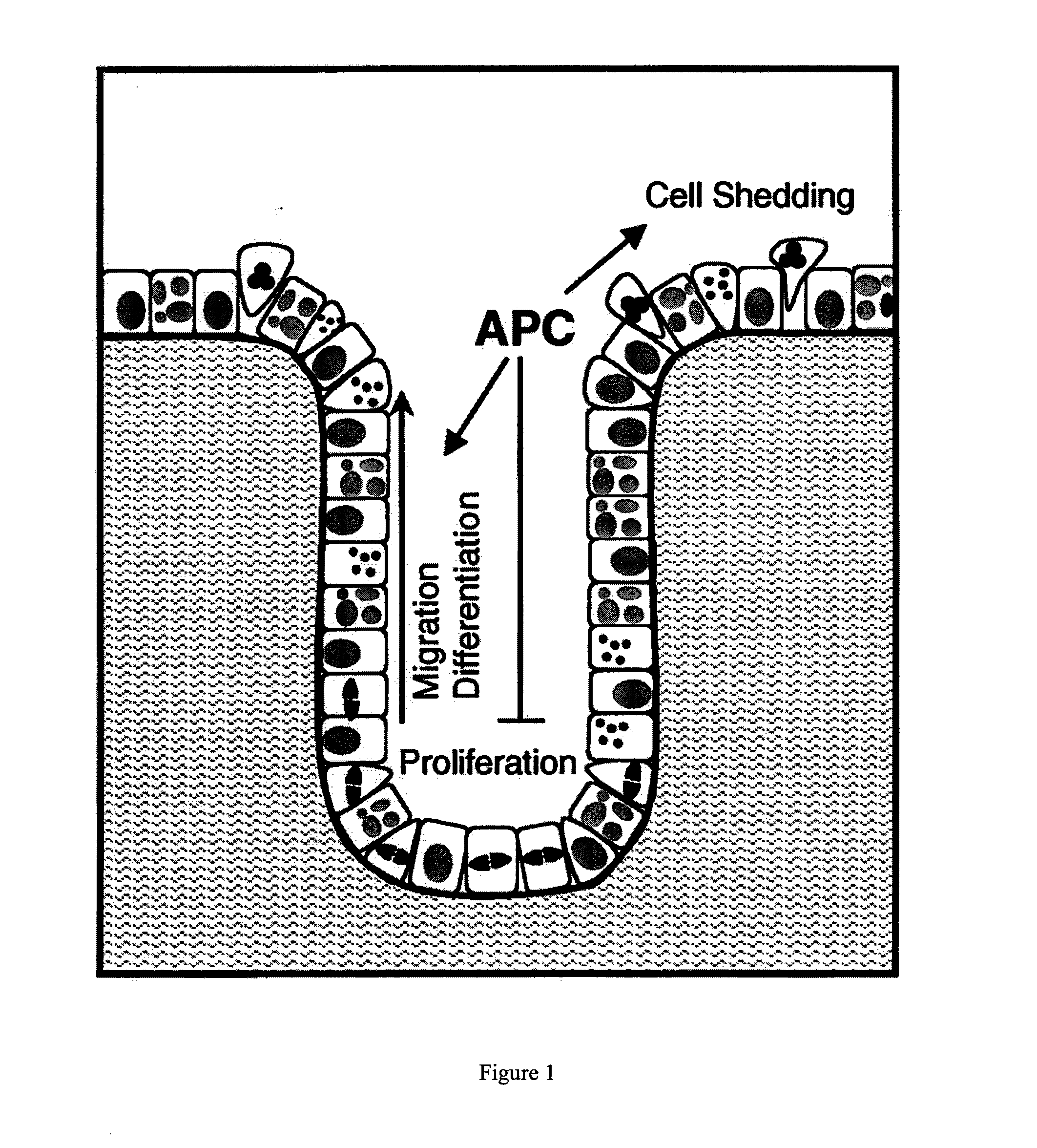 Therapeutics targeting truncated adenomatous polyposis coli (APC) proteins