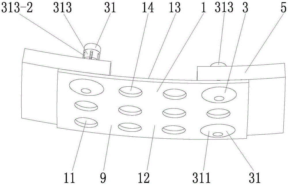 Laryngeal function repairing implanting system, fixing nail and nail gun