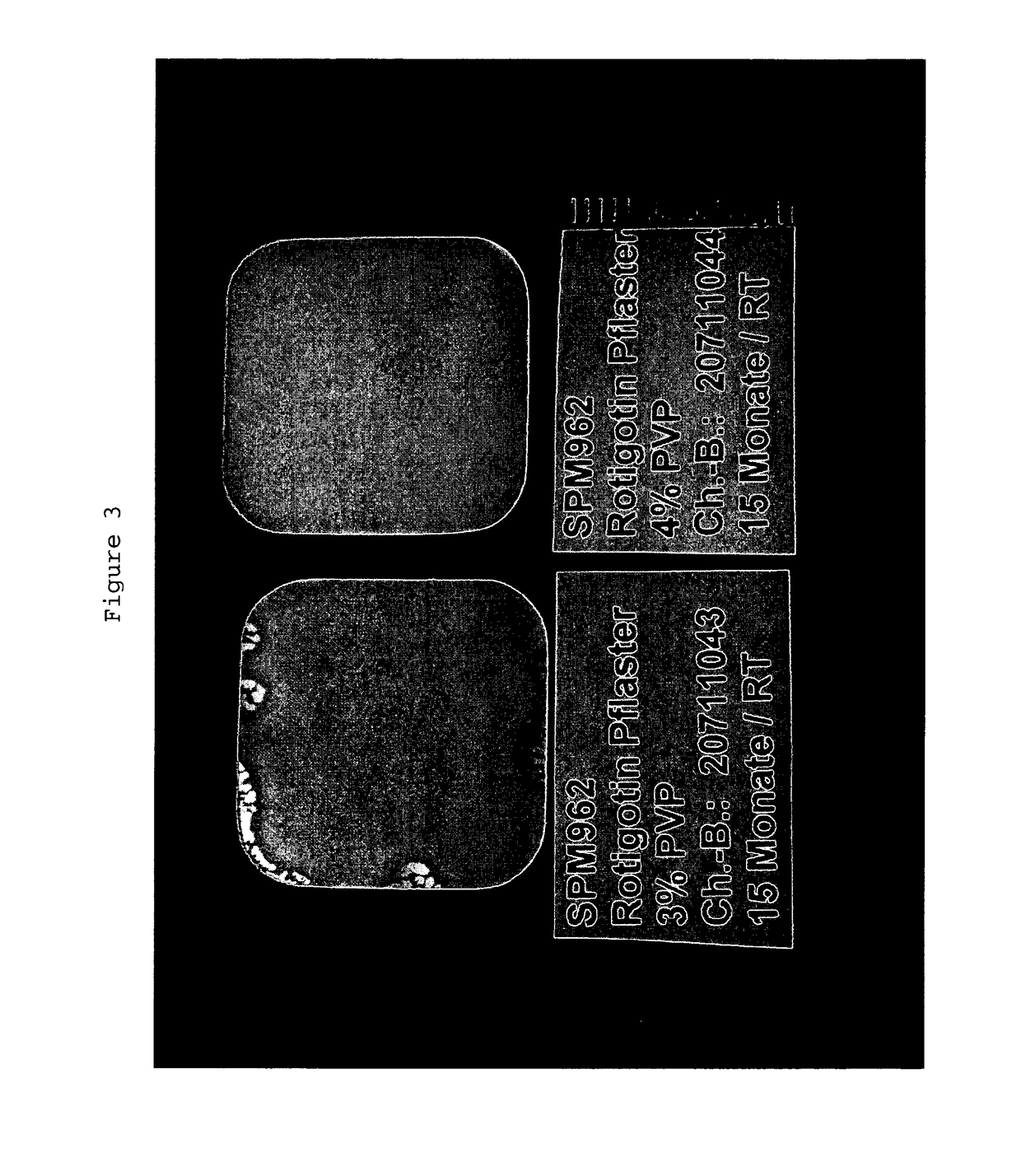 Polyvinylpyrrolidone for the stabilization of a solid dispersion of the non-crystalline form of rotigotine