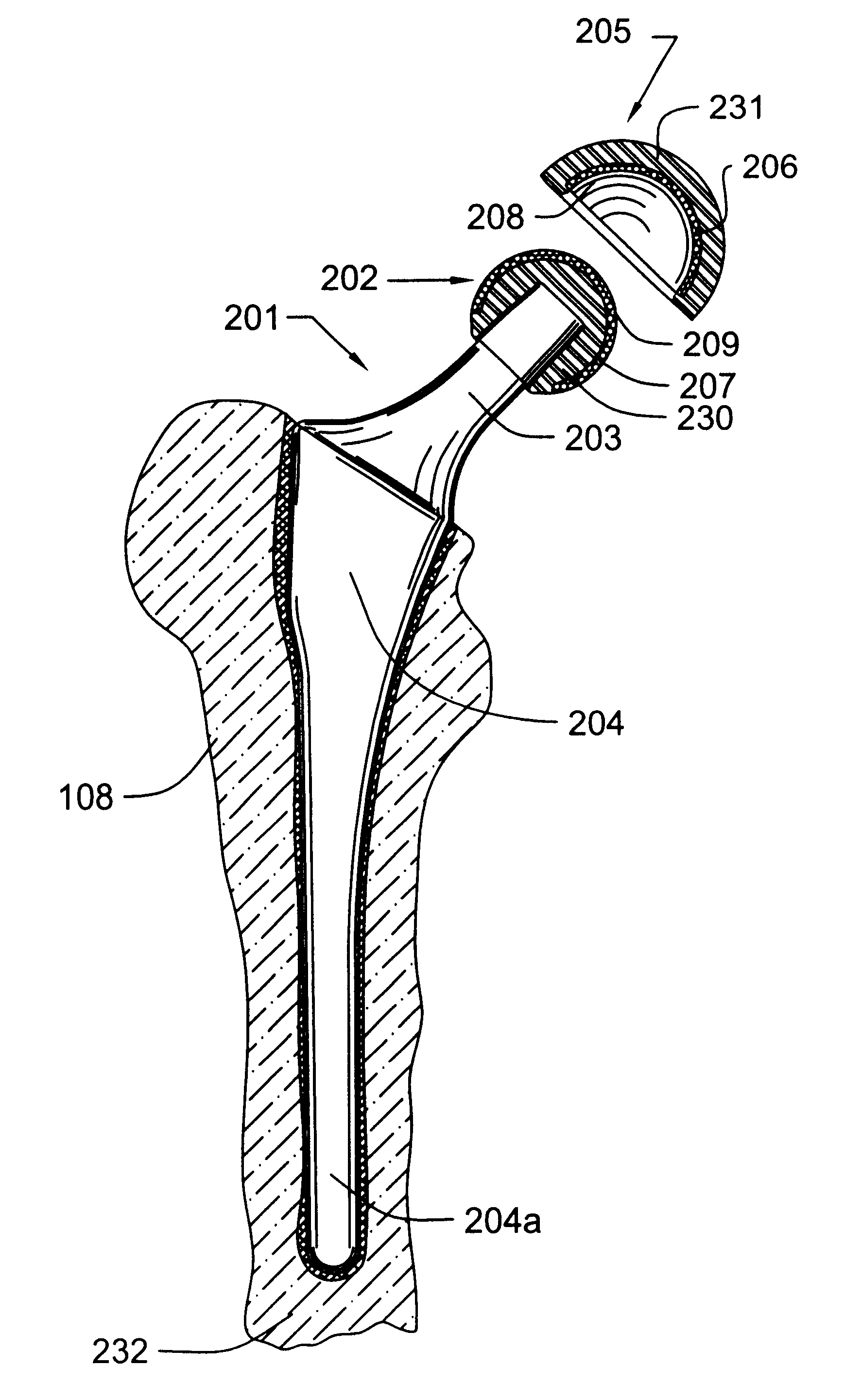 Methods for manufacturing a diamond prosthetic joint component