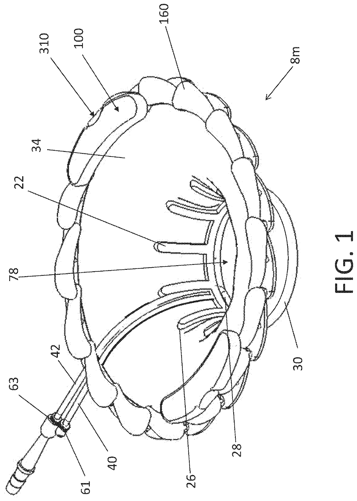 Methods and apparatus for prevention of surgical site infection