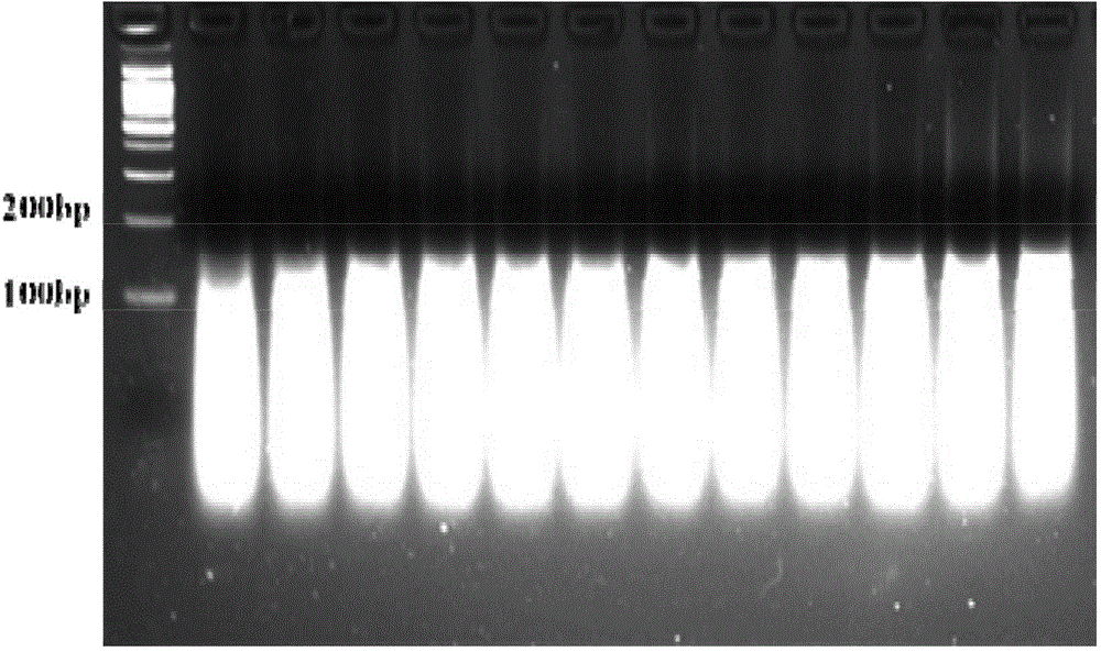 SCML4 gene sequence and expression change detection and application of SCML4 gene sequence in coronary heart disease prediction