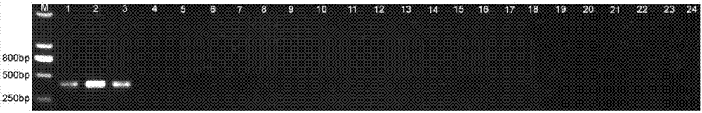 Molecular detection primer specific for phytophthora sojae and application thereof