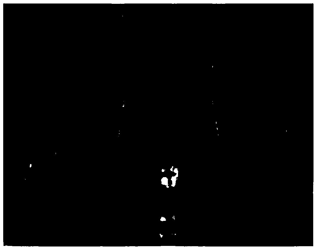 A scaffold material for treating femoral head necrosis and its preparation method