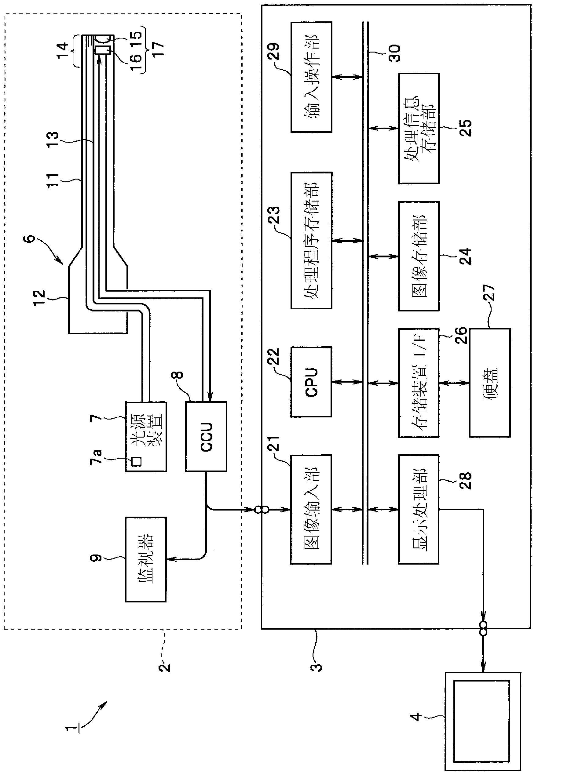 Diagnosis assistance apparatus