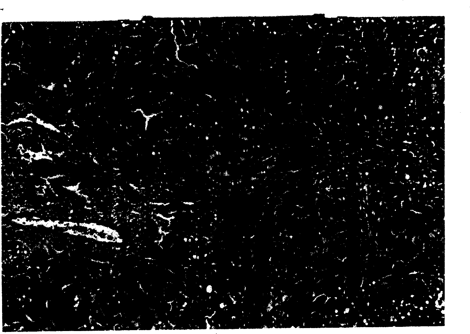 Application of artesunate for preparing medicine to treat fibrosis of liver