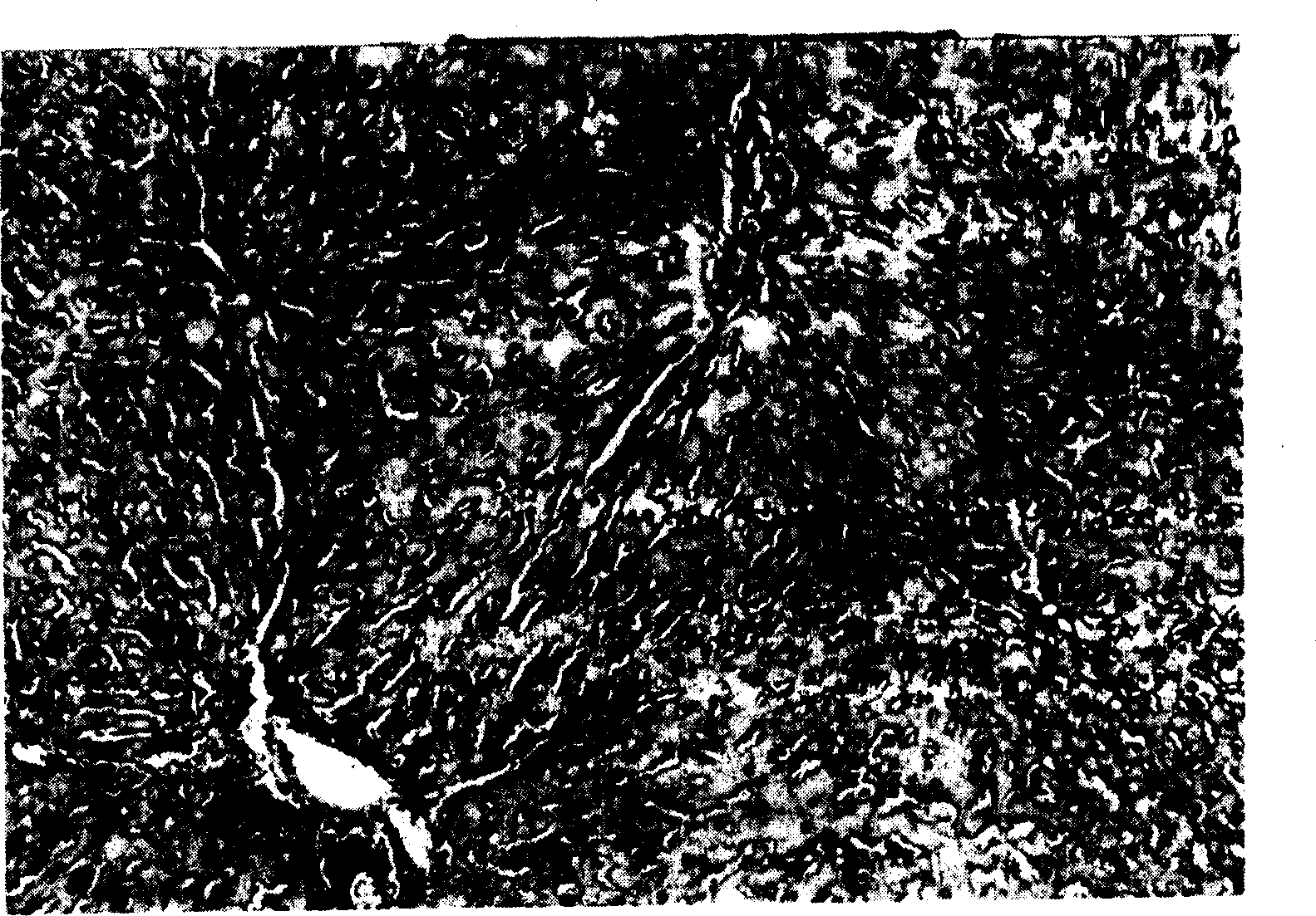 Application of artesunate for preparing medicine to treat fibrosis of liver