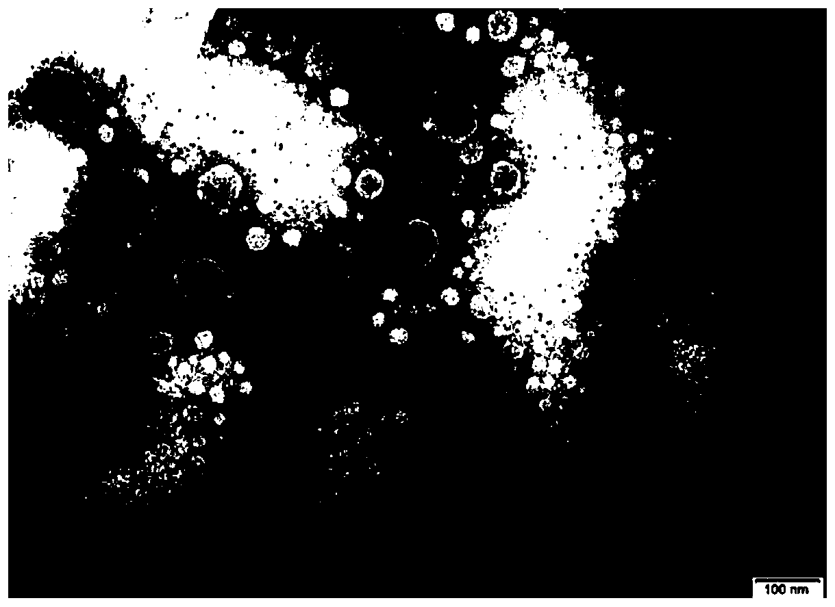 Insulin flexible particles and preparation thereof