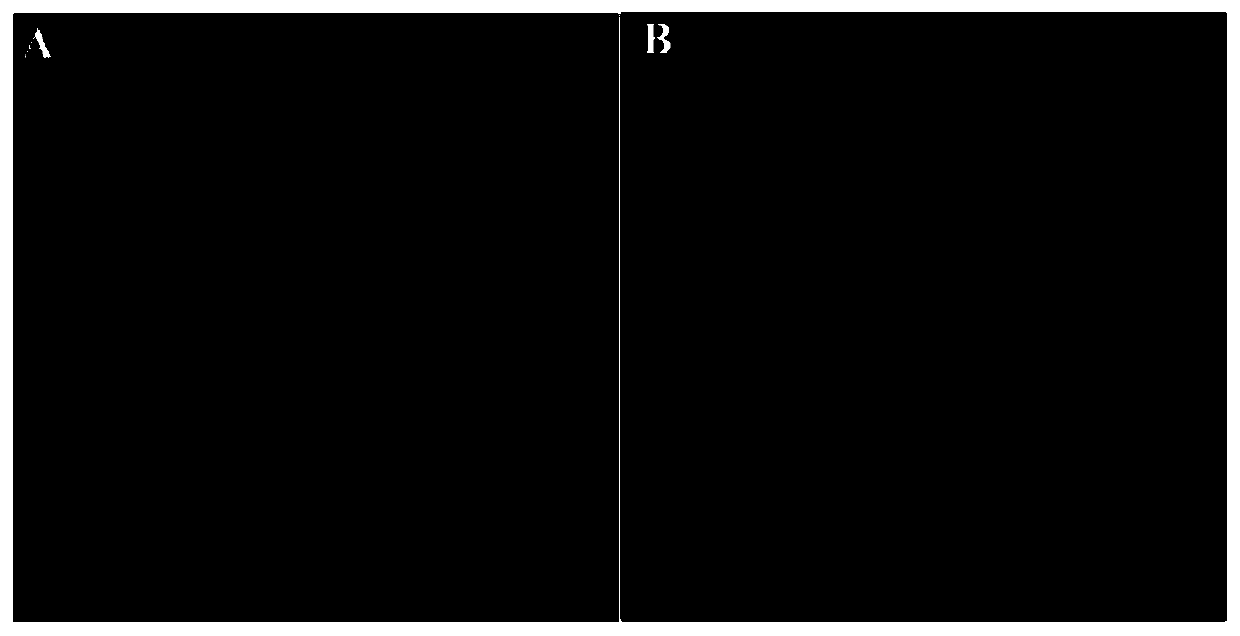 Insulin flexible particles and preparation thereof