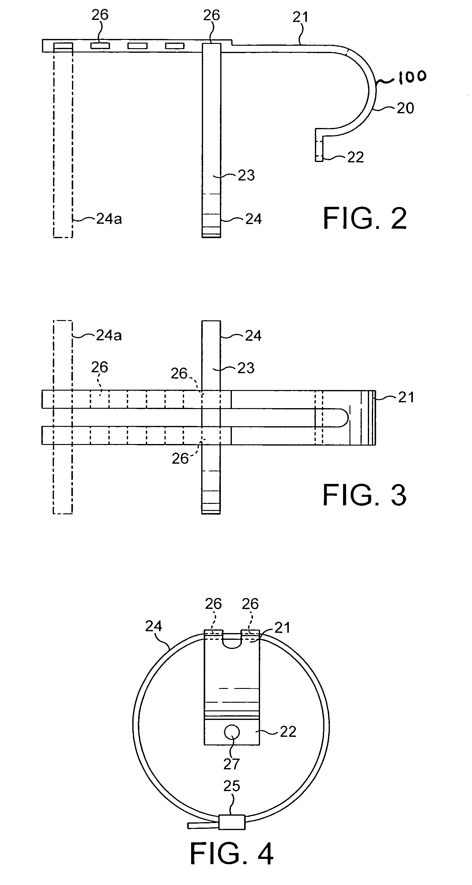 Greater trochanteric re-attachment device