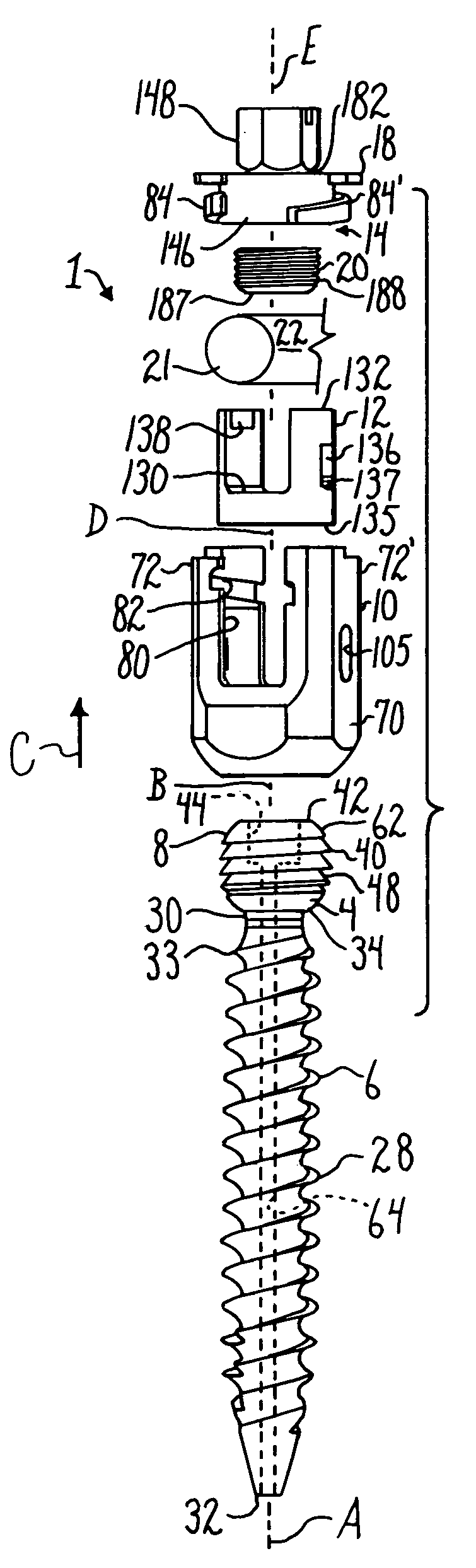 Polyaxial bone anchor with helical capture connection, insert and dual locking assembly