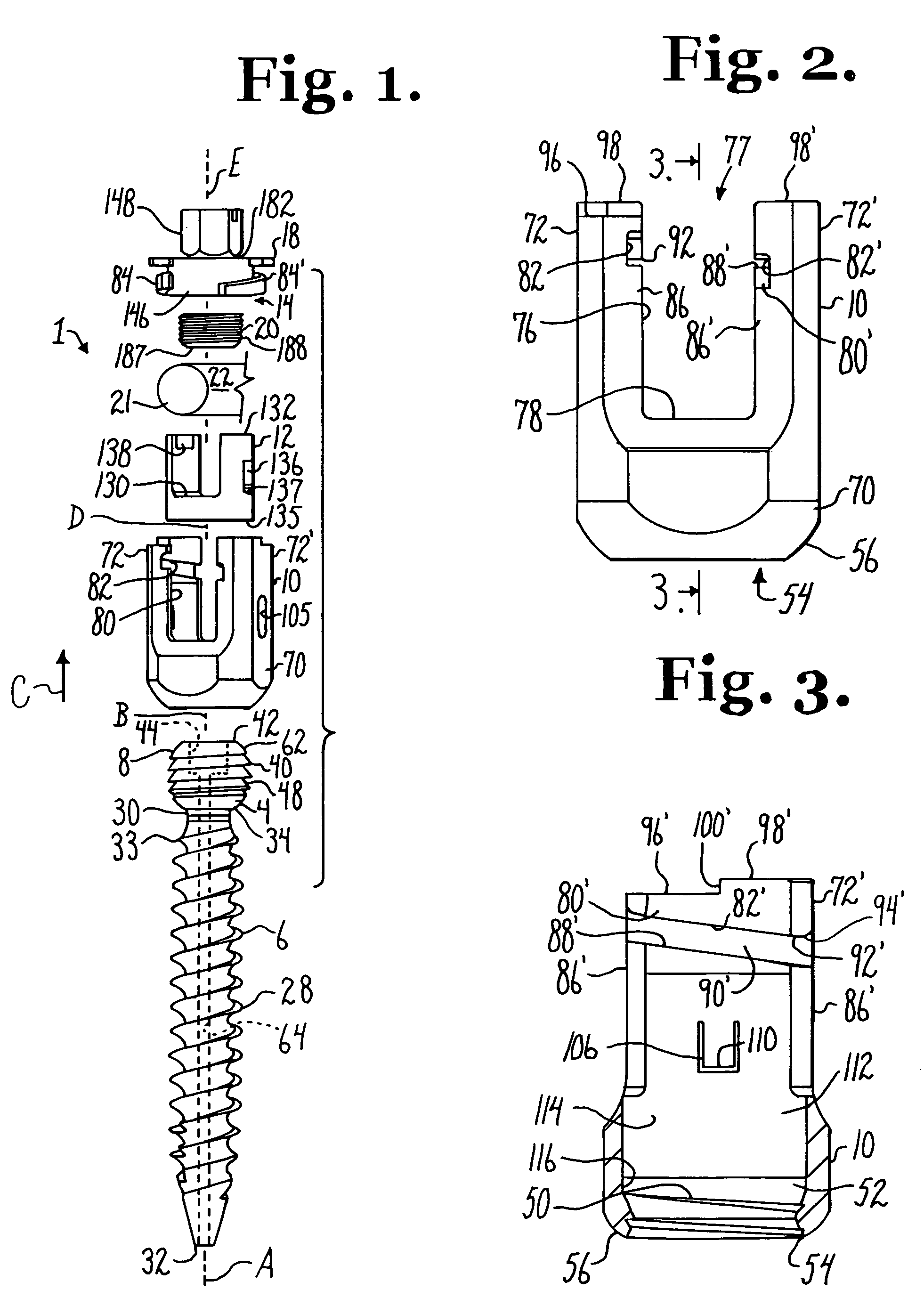 Polyaxial bone anchor with helical capture connection, insert and dual locking assembly