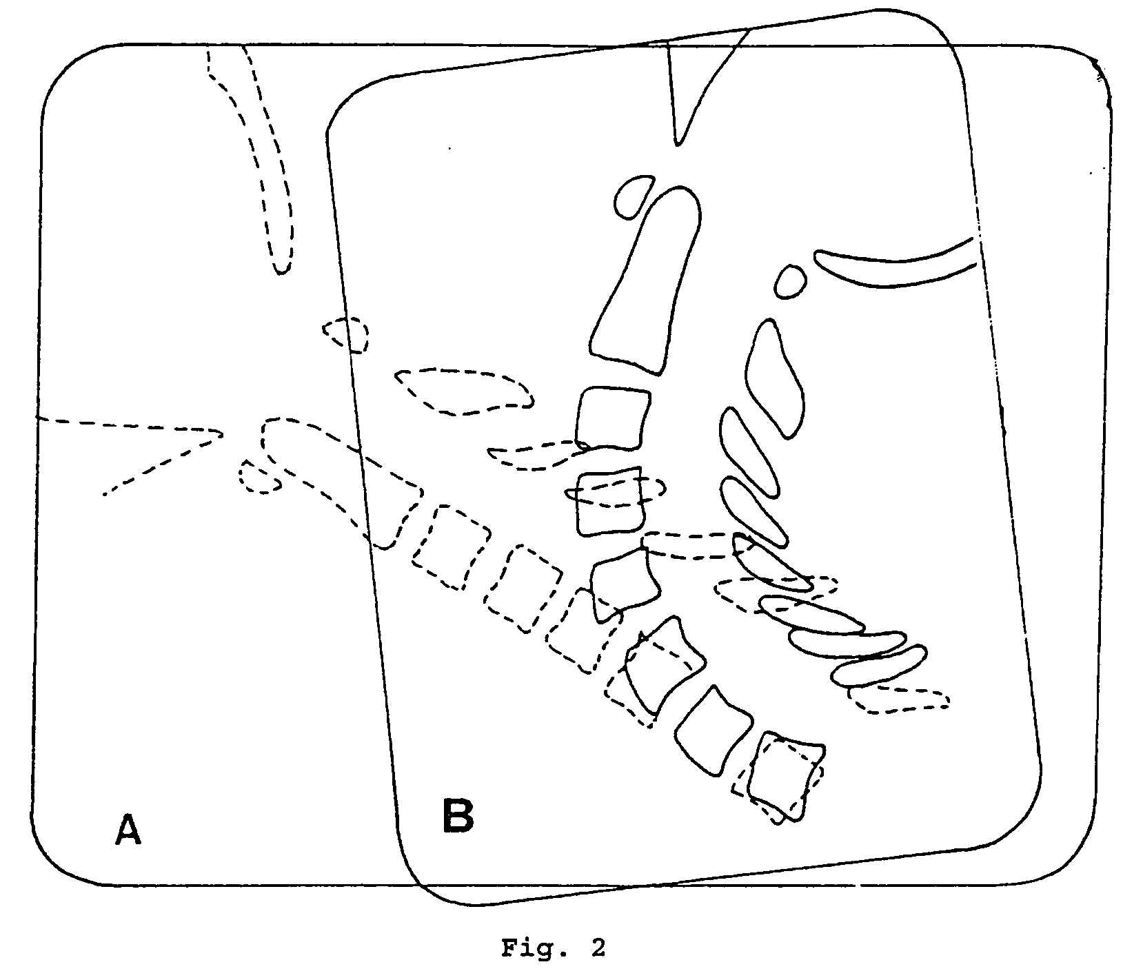 Method of performing measurements on digital images