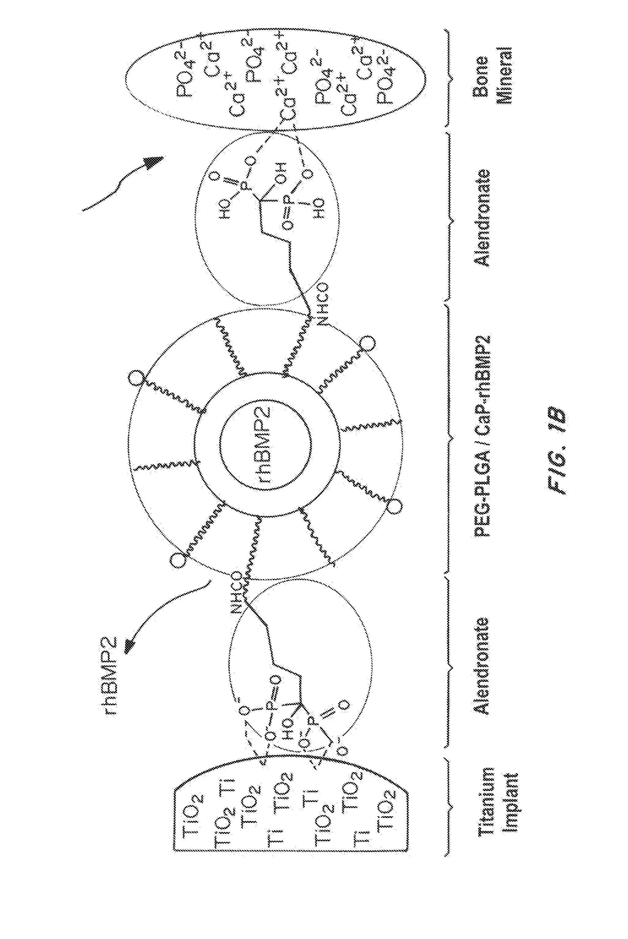 Bone and metal targeted polymeric nanoparticles