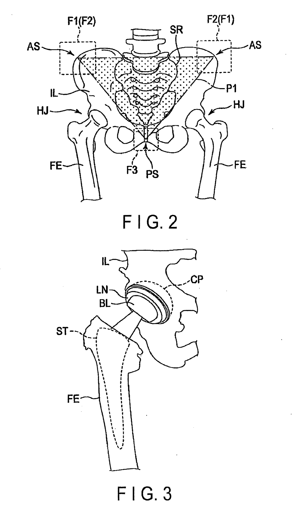 Body position fixing apparatus and angle indicator