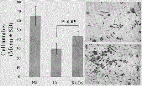 RGDS-modified curcumin and preparation, bioactivity and application thereof