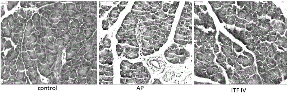 Effect of long-chain inulin in adjusting acute pancreatitis and related tissue damage caused thereby