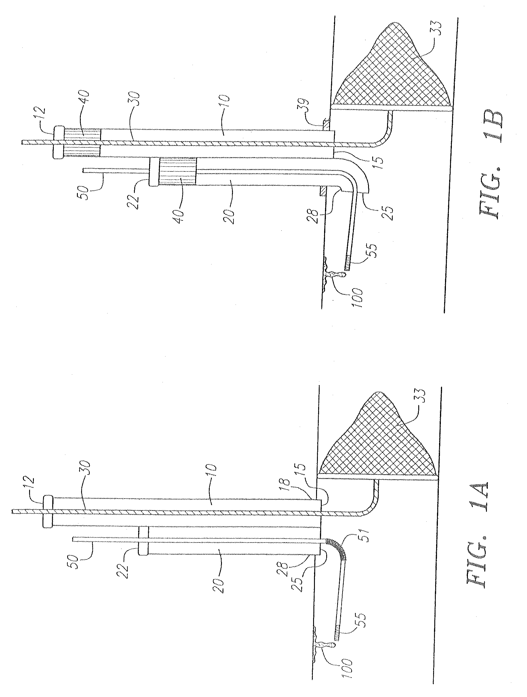 Direct Access Atherectomy Devices and Methods of Use