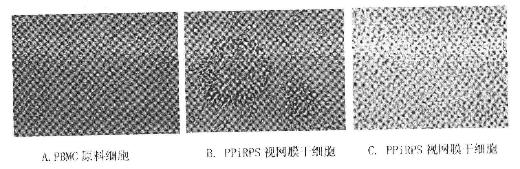 Method for generating autologous retinal stem cells and autologous retinal cells by reversely differentiating human body cells, kit and application of autologous retinal stem cells and autologous retinal cells