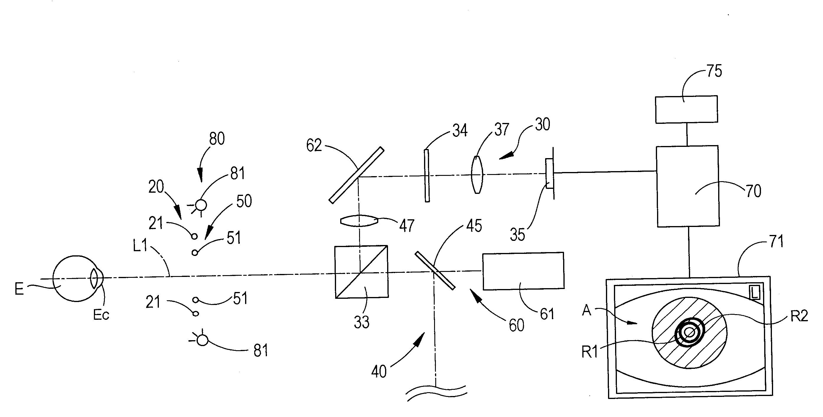 Cornea shape measurement apparatus