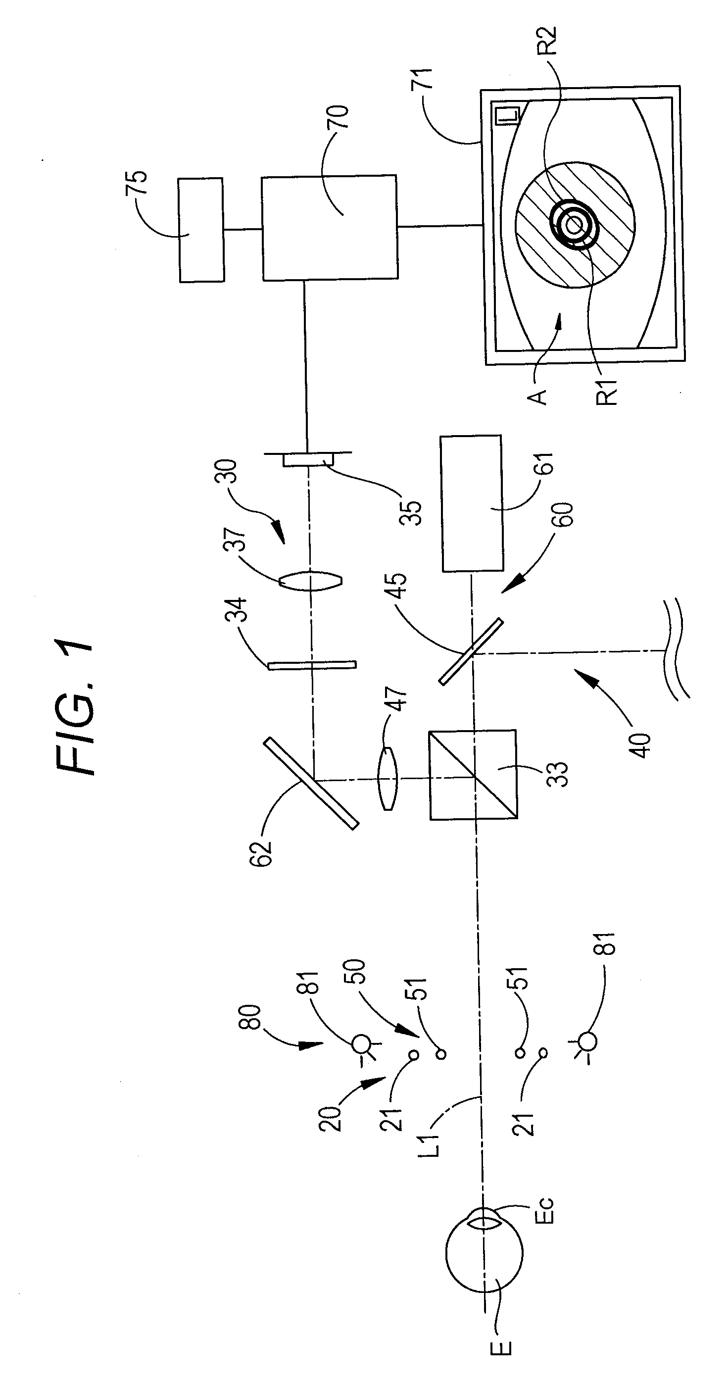 Cornea shape measurement apparatus