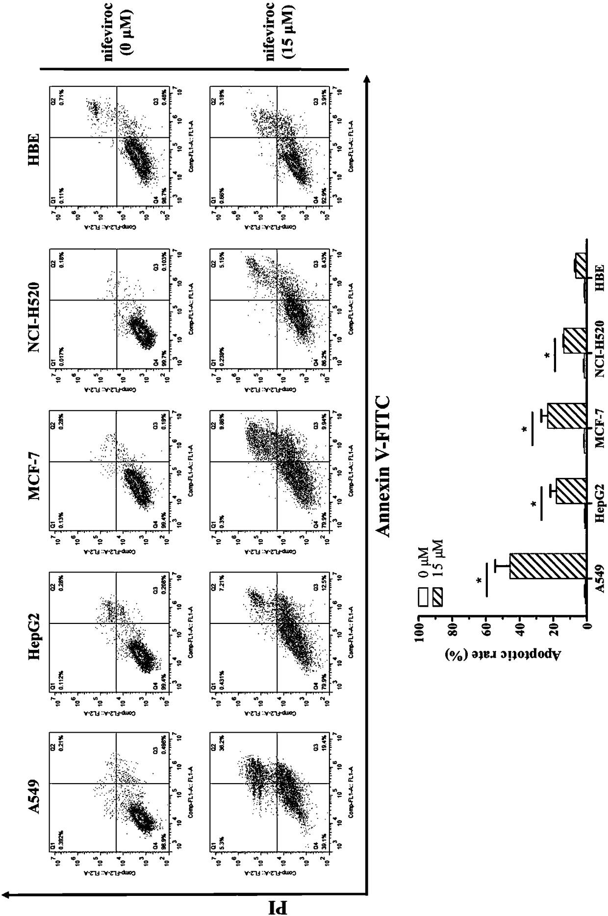 Application of Nifeviroc in preparing antitumor drug