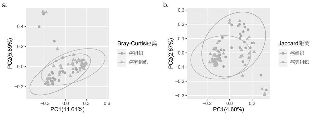 Fungus flora related to esophageal squamous cell carcinoma morbidity, and screening method and application of fungus flora